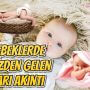 Bebeklerde Gözden Gelen Sarı Akıntı